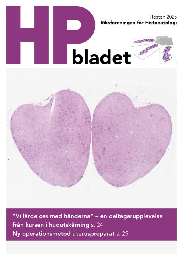 HP Bladet Hösten 2025